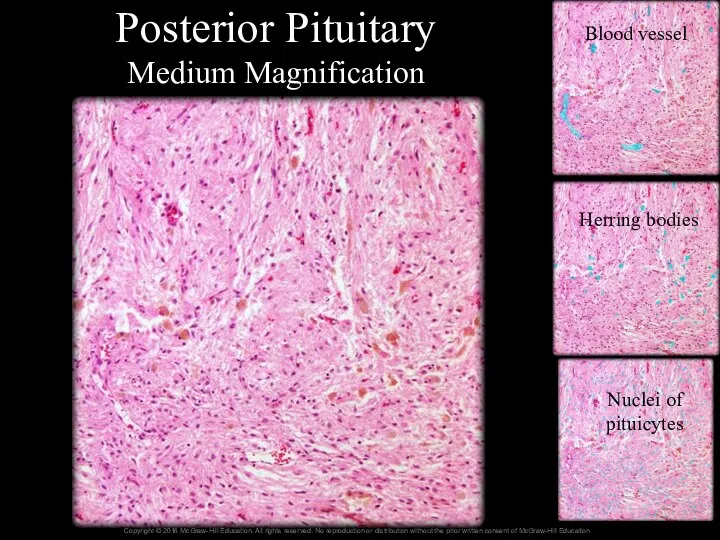 Posterior Pituitary Medium Magnification Blood vessel Herring bodies Nuclei of pituicytes
