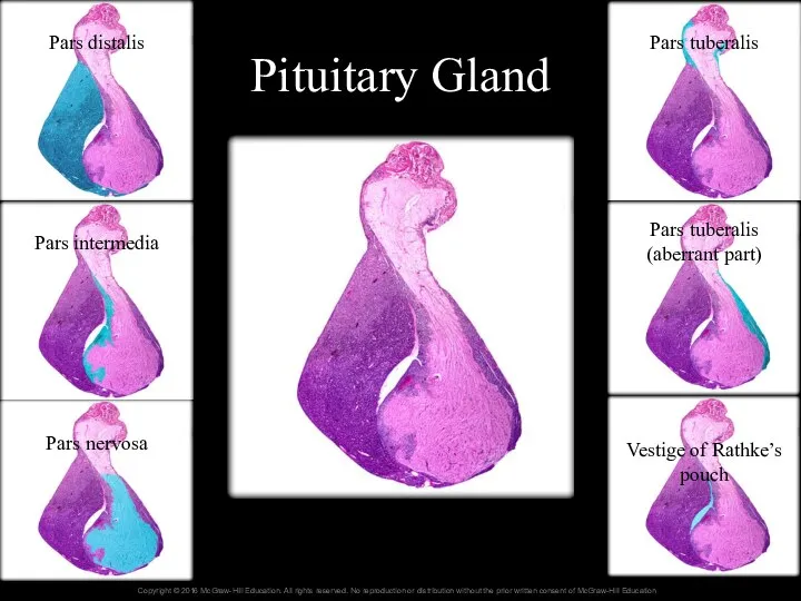 Pituitary Gland Pars distalis Pars intermedia Pars nervosa Pars tuberalis Pars