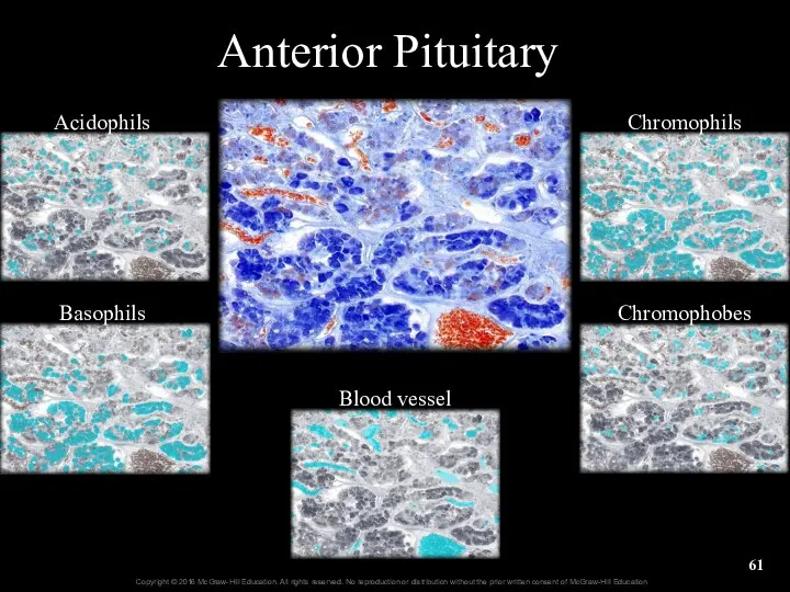 Anterior Pituitary Acidophils Basophils Blood vessel Chromophils Chromophobes