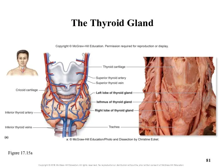 The Thyroid Gland Figure 17.15a