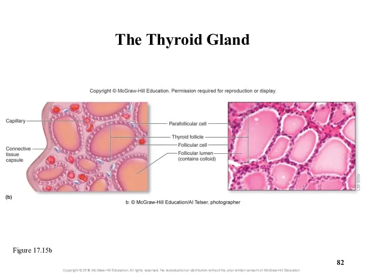 The Thyroid Gland Figure 17.15b