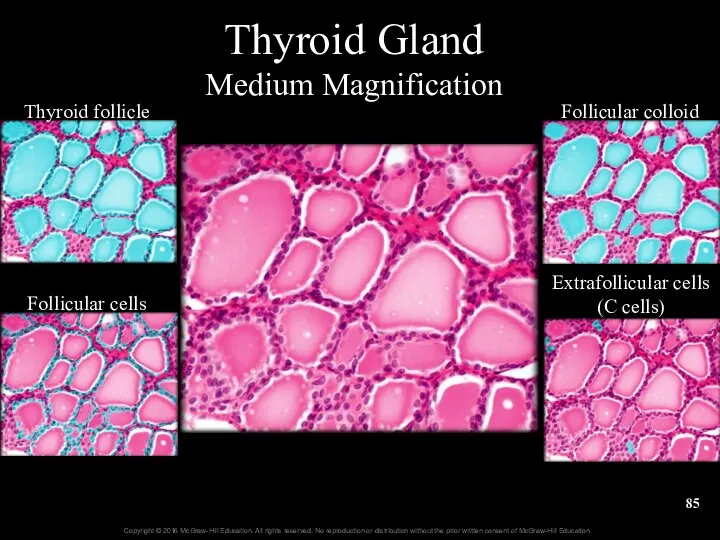 Thyroid Gland Medium Magnification Thyroid follicle Follicular cells Follicular colloid Extrafollicular cells (C cells)