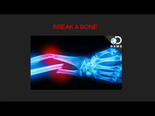 BREAK A BONE