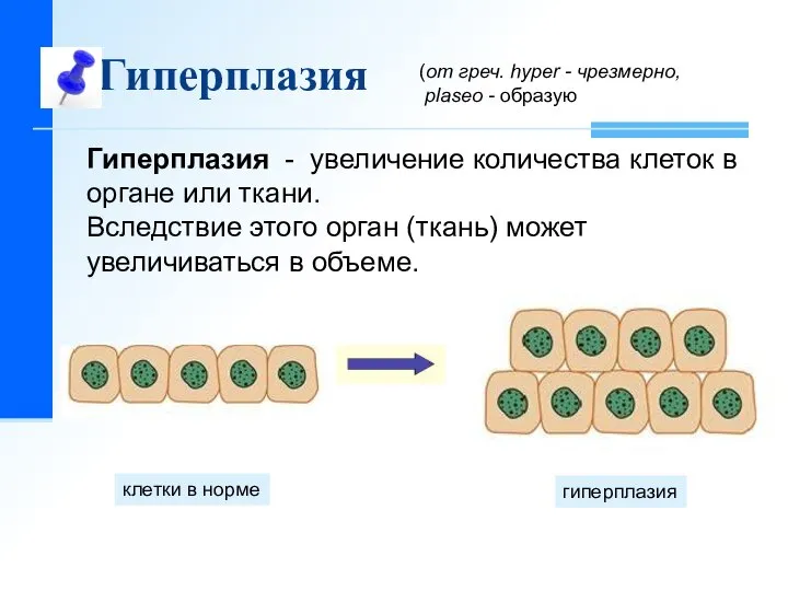 Гиперплазия клетки в норме гиперплазия Гиперплазия - увеличение количества клеток в