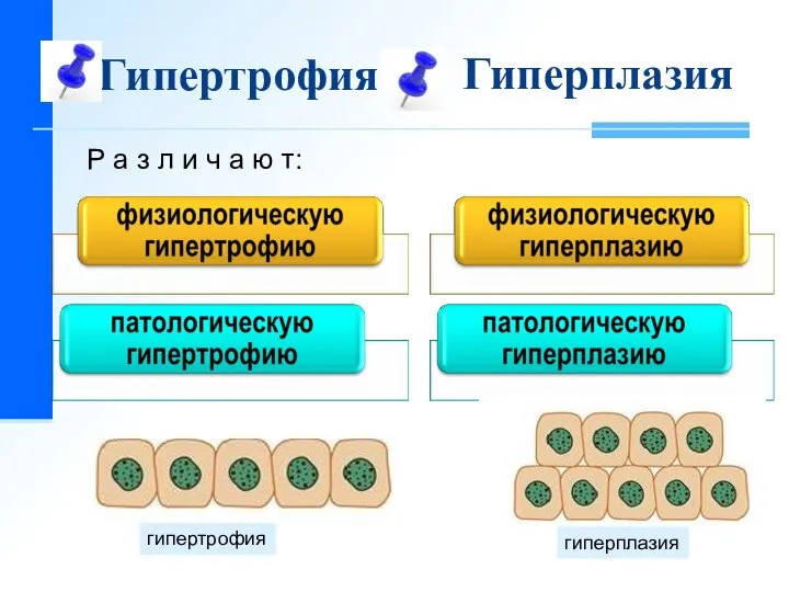 Гипертрофия Р а з л и ч а ю т: Гиперплазия гипертрофия гиперплазия