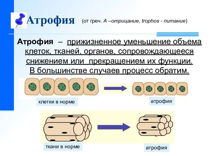 Атрофия Атрофия – прижизненное уменьшение объема клеток, тканей, органов, сопровождающееся снижением