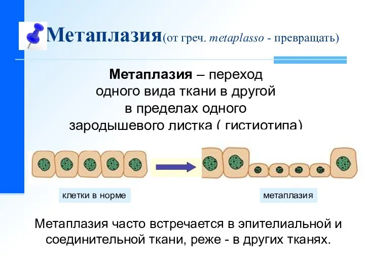 Метаплазия(от греч. metaplasso - превращать) Метаплазия – переход одного вида ткани