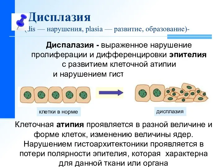 Дисплазия (dis — нарушения, рlasia — развитие, образование)- Диспалазия - выраженное