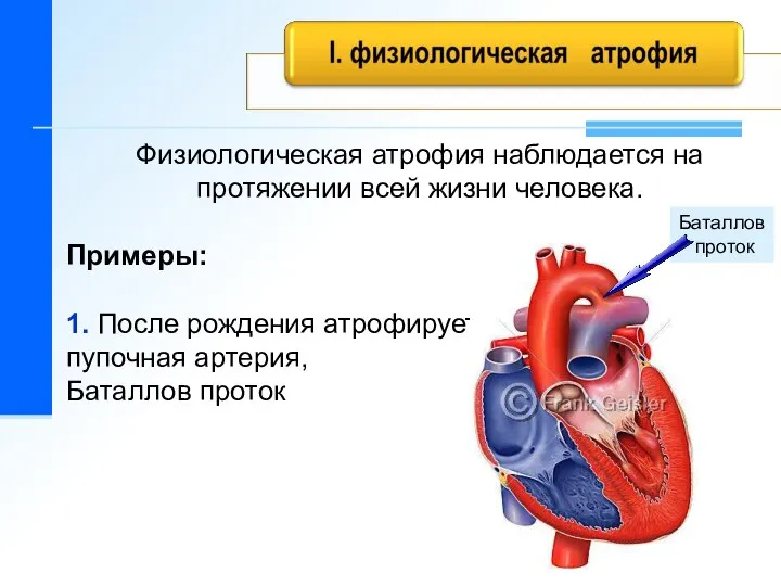 Физиологическая атрофия наблюдается на протяжении всей жизни человека. Примеры: 1. После