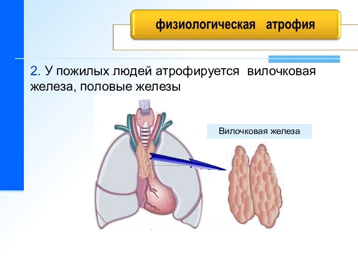 2. У пожилых людей атрофируется вилочковая железа, половые железы Вилочковая железа