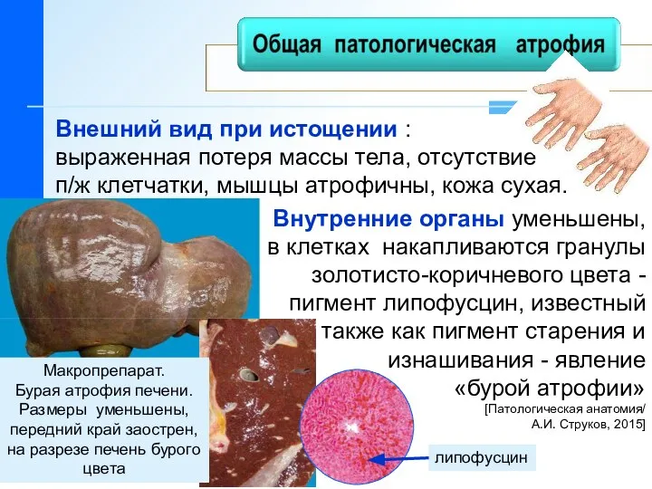 Внешний вид при истощении : выраженная потеря массы тела, отсутствие п/ж