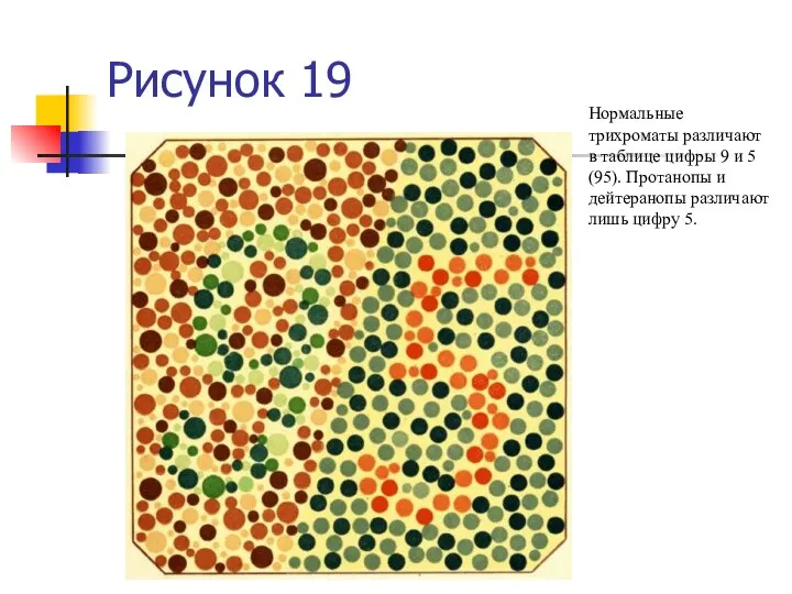 Рисунок 19 Нормальные трихроматы различают в таблице цифры 9 и 5