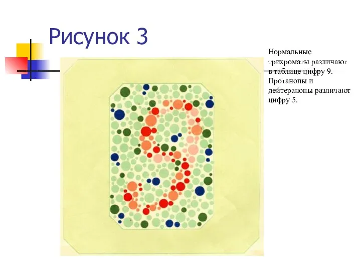 Рисунок 3 Нормальные трихроматы различают в таблице цифру 9. Протанопы и дейтеранопы различают цифру 5.