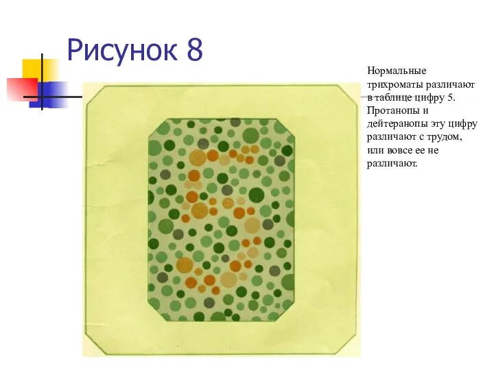 Рисунок 8 Нормальные трихроматы различают в таблице цифру 5. Протанопы и