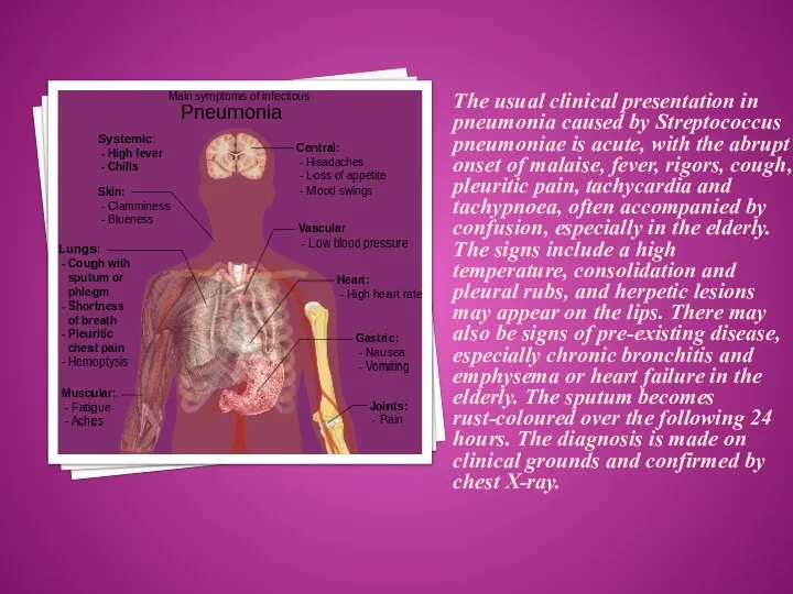 The usual clinical presentation in pneumonia caused by Streptococcus pneumoniae is