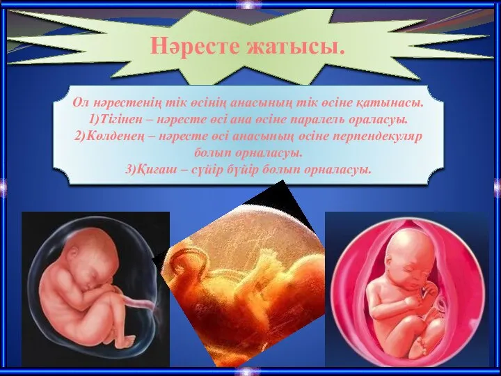 Нәресте жатысы. Ол нәрестенің тік өсінің анасының тік өсіне қатынасы. 1)Тігінен