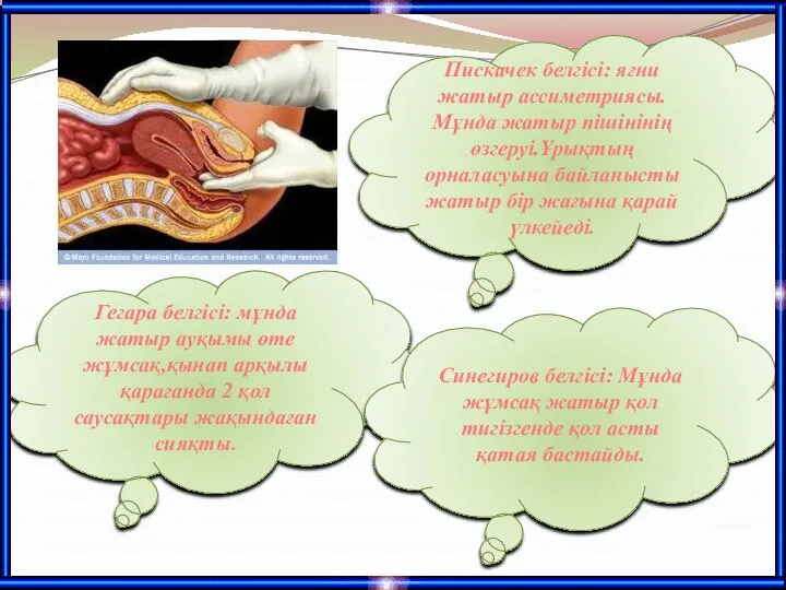 Гегара белгісі: мұнда жатыр ауқымы өте жұмсақ,қынап арқылы қарағанда 2 қол