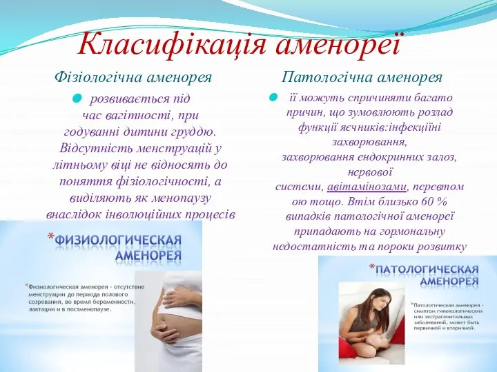 Класифікація аменореї Фізіологічна аменорея Патологічна аменорея розвивається під час вагітності, при