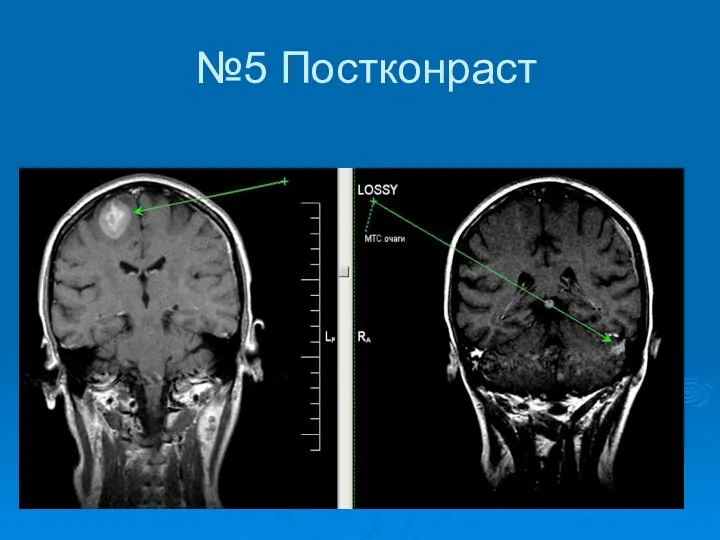 №5 Постконраст