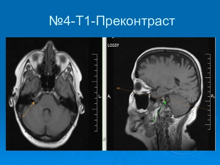 №4-Т1-Преконтраст