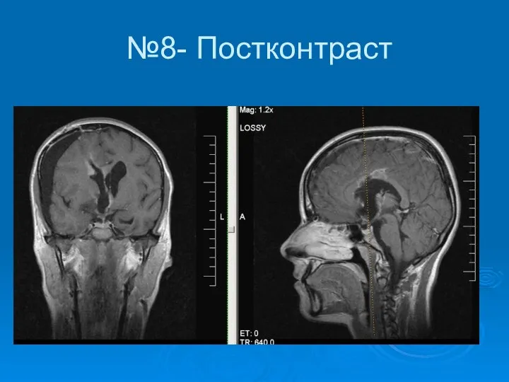 №8- Постконтраст