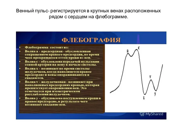 Венный пульс- регистрируется в крупных венах расположенных рядом с сердцем на флебограмме.