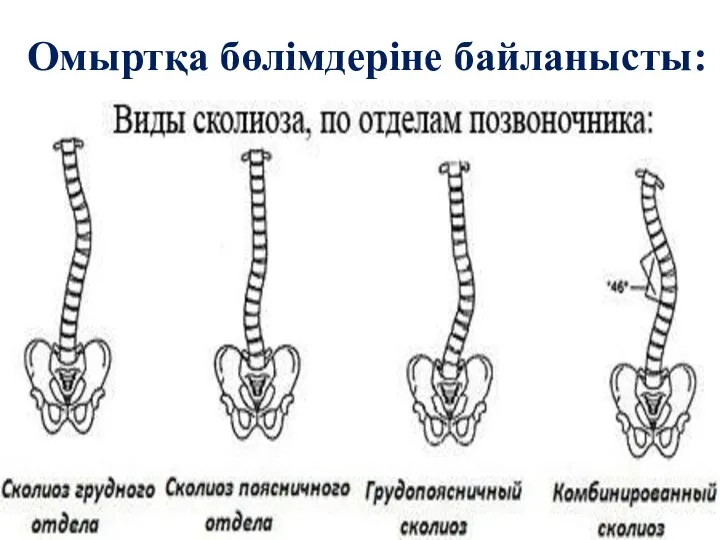 Омыртқа бөлімдеріне байланысты: