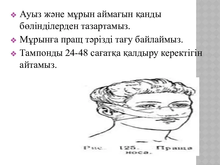 Ауыз және мұрын аймағын қанды бөлінділерден тазартамыз. Мұрынға пращ тәрізді тағу