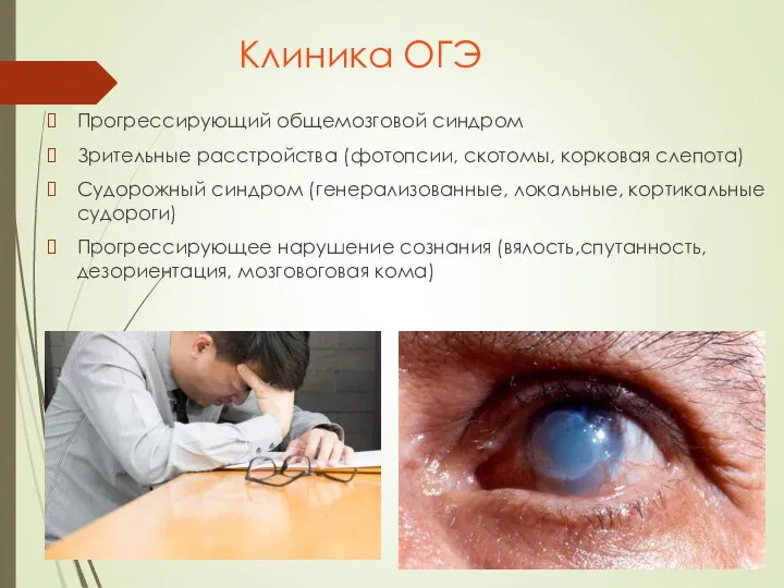 Клиника ОГЭ Прогрессирующий общемозговой синдром Зрительные расстройства (фотопсии, скотомы, корковая слепота)