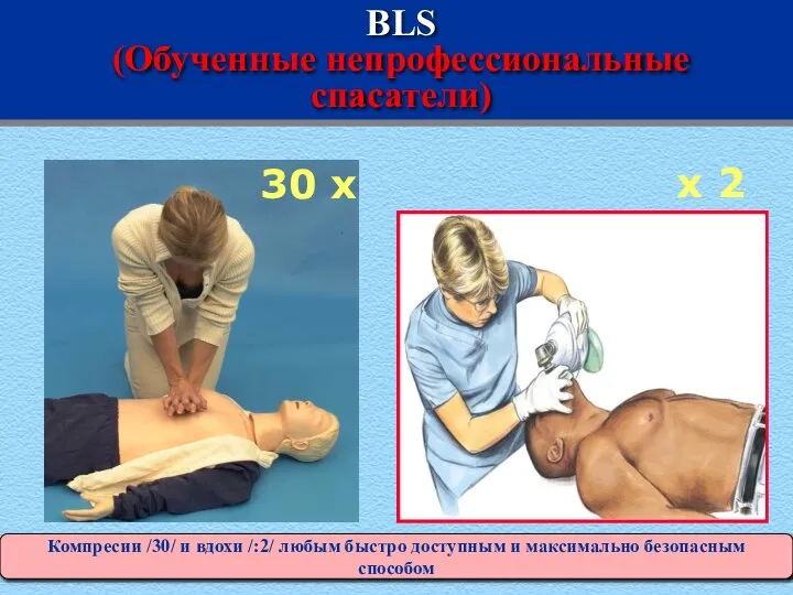 BLS (Обученные непрофессиональные спасатели) 30 x У всех пациентов (один реаниматор),