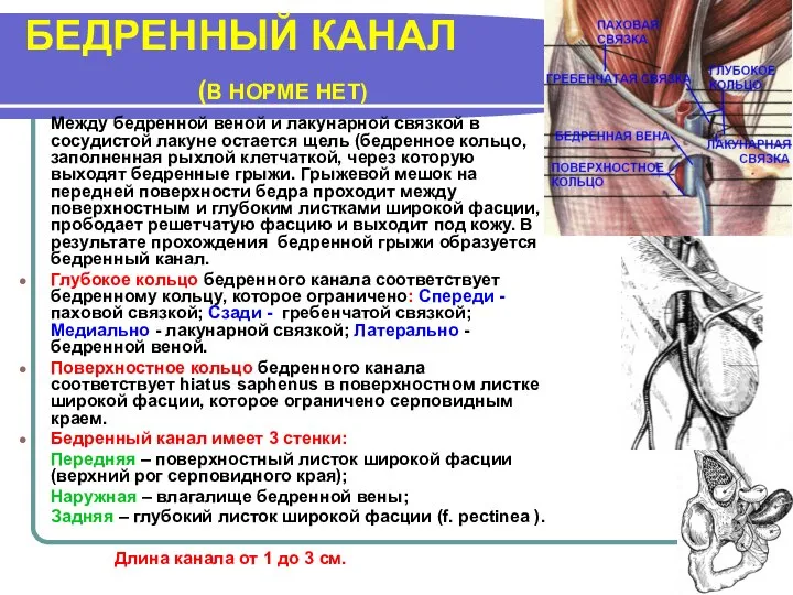 БЕДРЕННЫЙ КАНАЛ (В НОРМЕ НЕТ) Между бедренной веной и лакунарной связкой