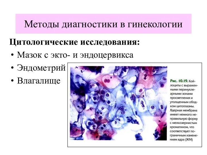 Цитологические исследования: Мазок с экто- и эндоцервикса Эндометрий Влагалище Методы диагностики в гинекологии