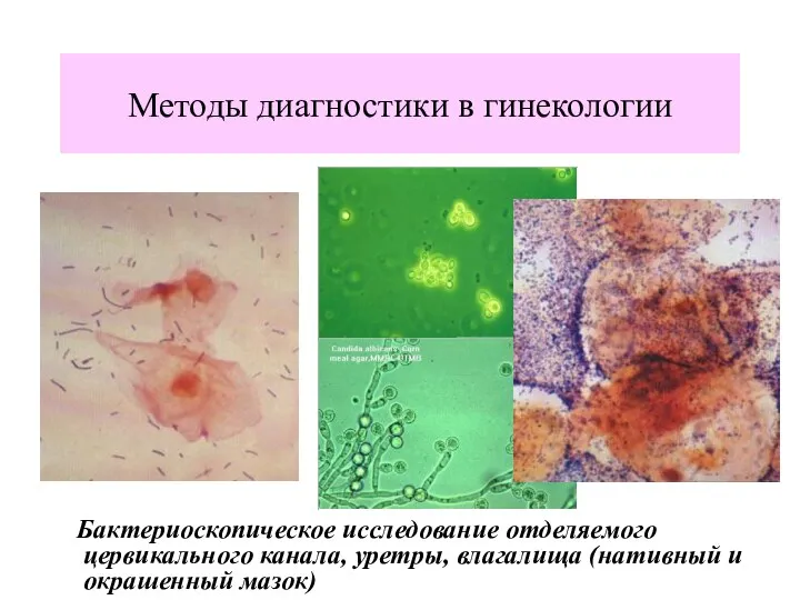 Методы диагностики в гинекологии Бактериоскопическое исследование отделяемого цервикального канала, уретры, влагалища (нативный и окрашенный мазок)