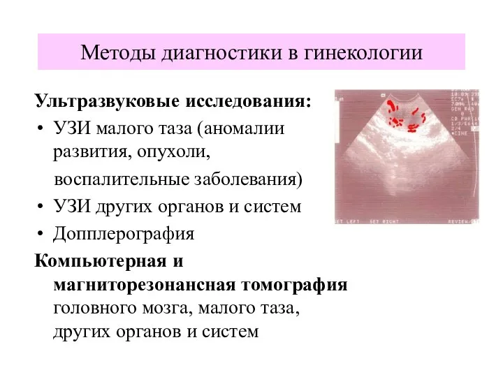 Ультразвуковые исследования: УЗИ малого таза (аномалии развития, опухоли, воспалительные заболевания) УЗИ