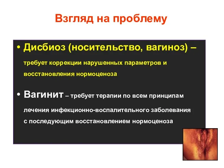 Взгляд на проблему Дисбиоз (носительство, вагиноз) – требует коррекции нарушенных параметров