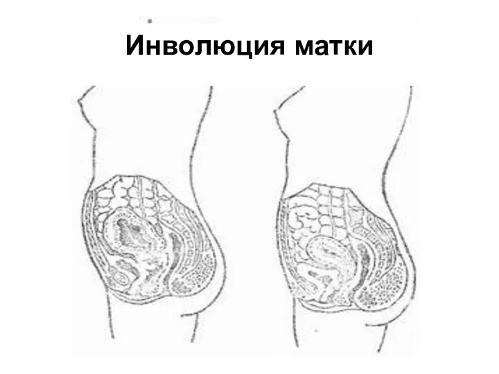 Инволюция матки