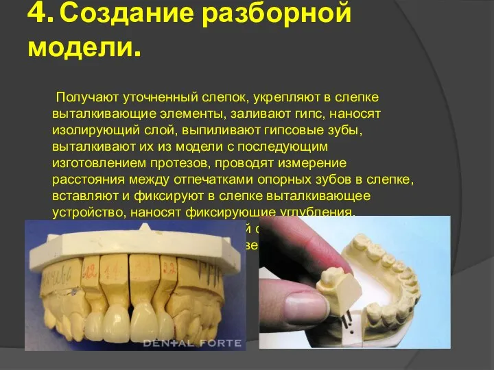 4. Создание разборной модели. Получают уточненный слепок, укрепляют в слепке выталкивающие