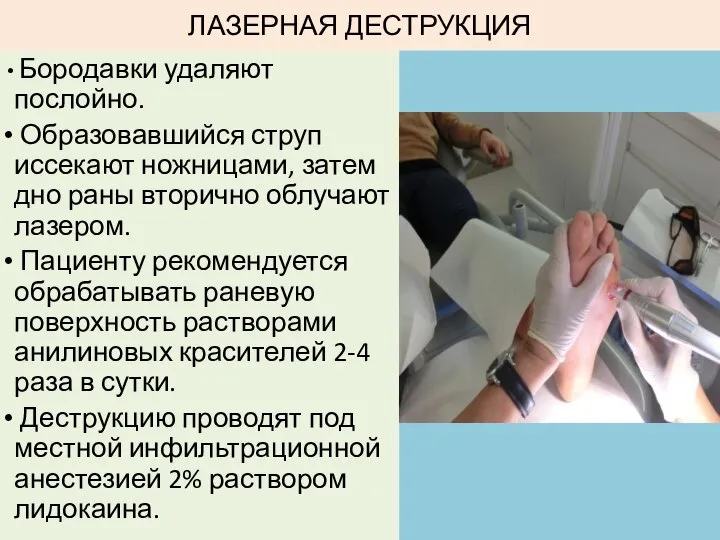 ЛАЗЕРНАЯ ДЕСТРУКЦИЯ Бородавки удаляют послойно. Образовавшийся струп иссекают ножницами, затем дно