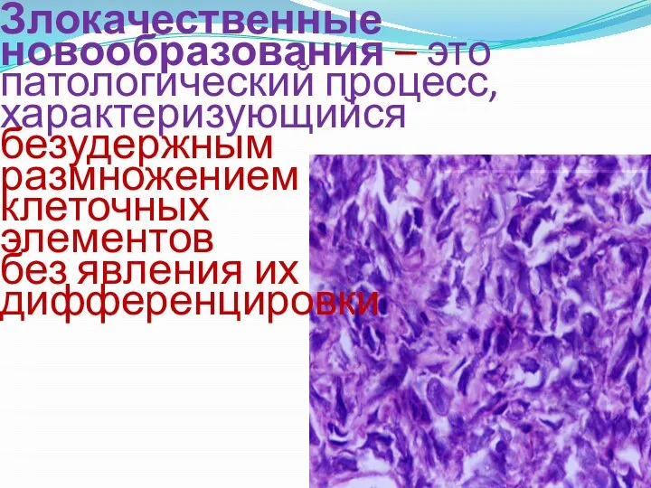 Злокачественные новообразования – это патологический процесс, характеризующийся безудержным размножением клеточных элементов без явления их дифференцировки