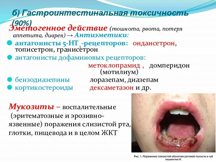 б) Гастроинтестинальная токсичность (90%) Эметогенное действие (тошнота, рвота, потеря аппетита, диарея)