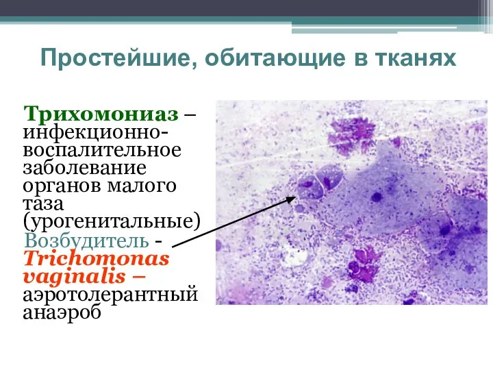 Простейшие, обитающие в тканях Трихомониаз – инфекционно-воспалительное заболевание органов малого таза