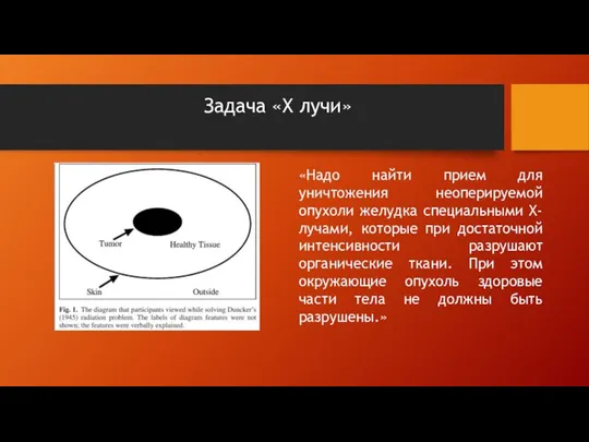 Задача «Х лучи» «Надо найти прием для уничтожения неоперируемой опухоли желудка