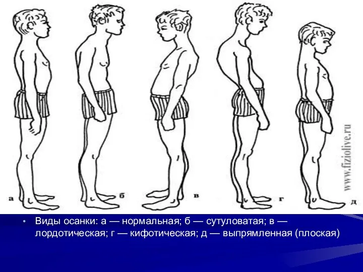 Виды осанки: а — нормальная; б — сутуловатая; в — лордотическая;