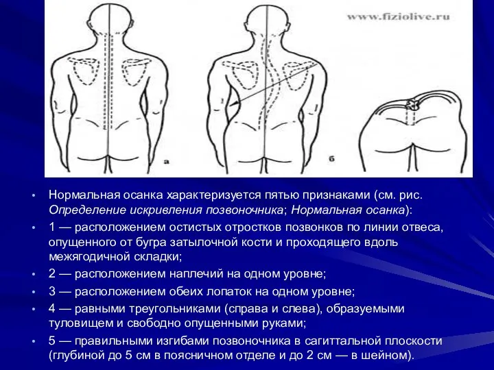 Нормальная осанка характеризуется пятью признаками (см. рис. Определение искривления позвоночника; Нормальная