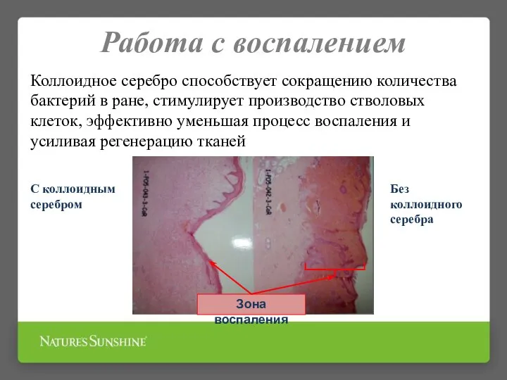 Работа с воспалением Коллоидное серебро способствует сокращению количества бактерий в ране,