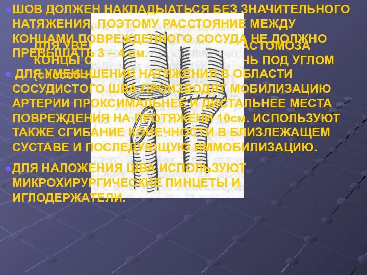 ДЛЯ УВЕЛИЧЕНИЯ ДИАМЕТРА АНАСТОМОЗА КОНЦЫ СОСУДА МОЖНО ПЕРЕСЕЧЬ ПОД УГЛОМ (способ