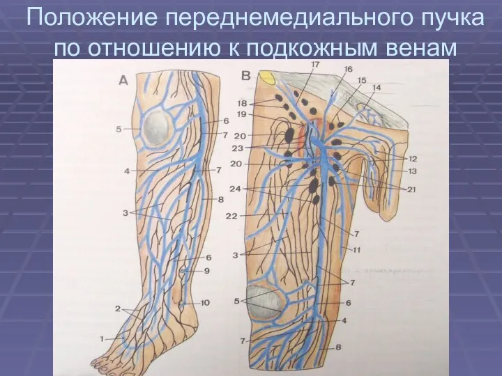 Положение переднемедиального пучка по отношению к подкожным венам