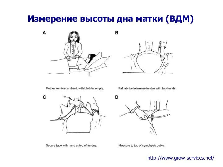 Измерение высоты дна матки (ВДМ) http://www.grow-services.net/