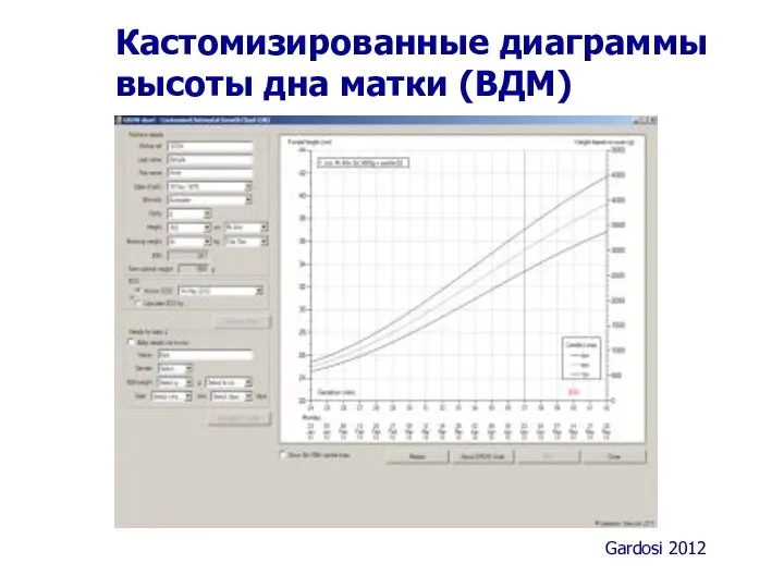 Кастомизированные диаграммы высоты дна матки (ВДМ) Gardosi 2012