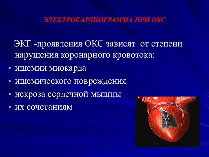 ЭЛЕКТРОКАРДИОГРАММА ПРИ ОКС ЭКГ -проявления ОКС зависят от степени нарушения коронарного